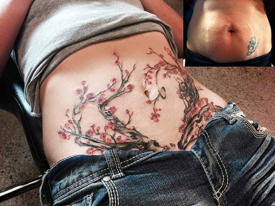 Can I Get a Tattoo to Cover Up Stretch Marks? 